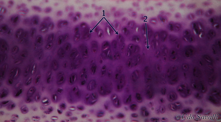 hyaline cartilage