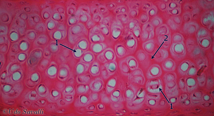 hyaline cartilage