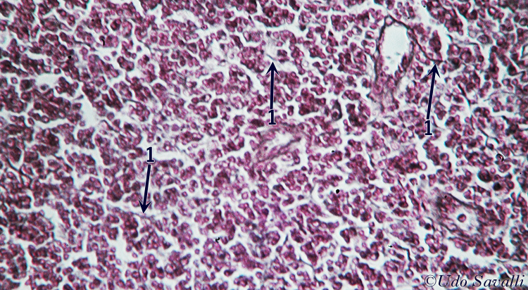 reticular CT