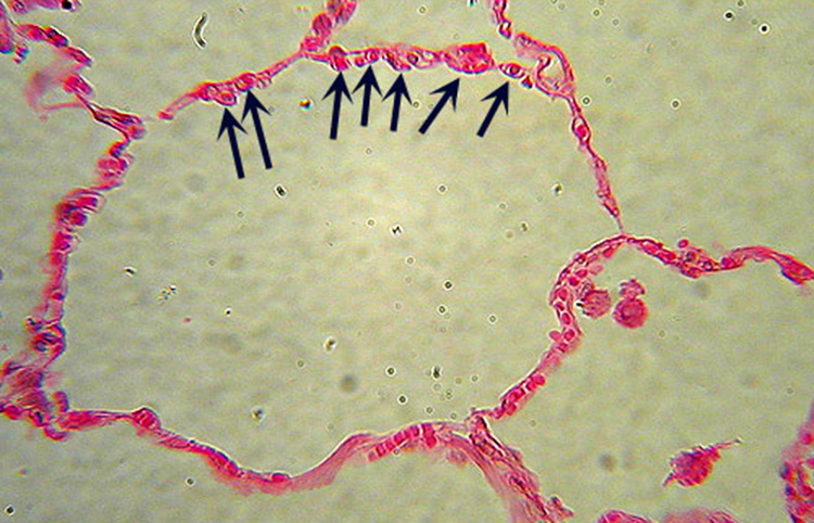 simple squamous epith