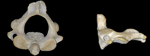 vertebra C