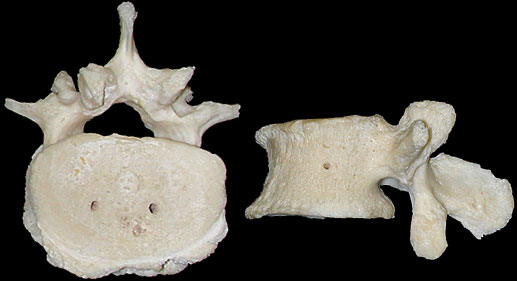 vertebra E