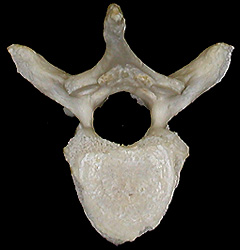 vertebrae