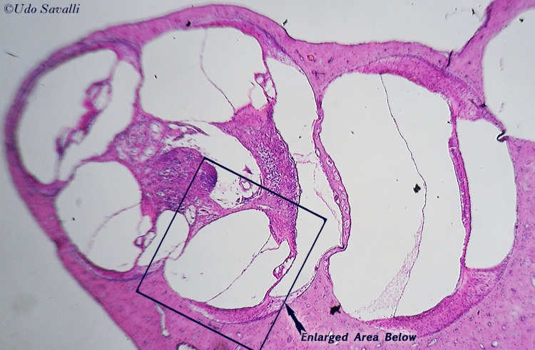 Cochlea entire unlabeled