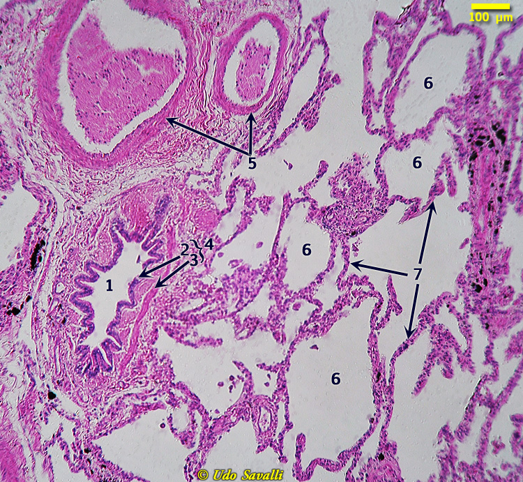 Lung Histology