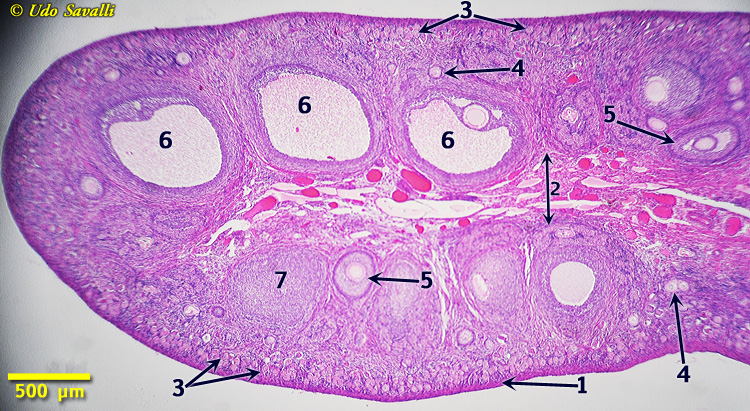 Ovary