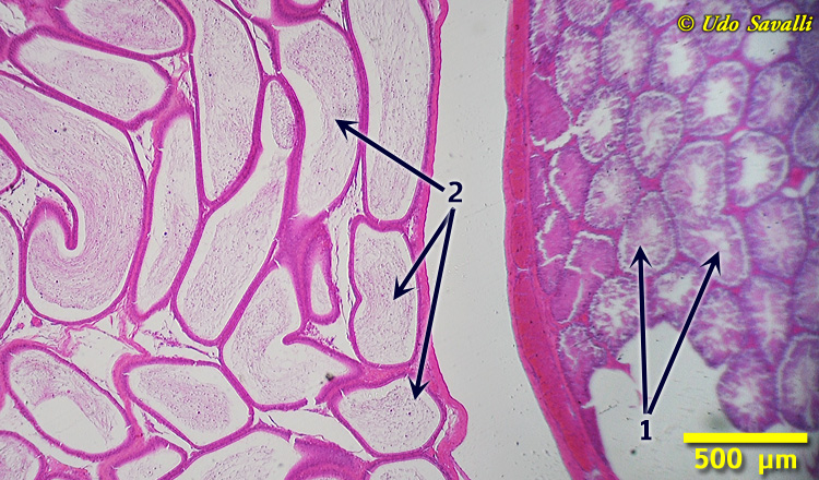 Testes & Epididymis