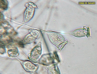 Vorticella sp.