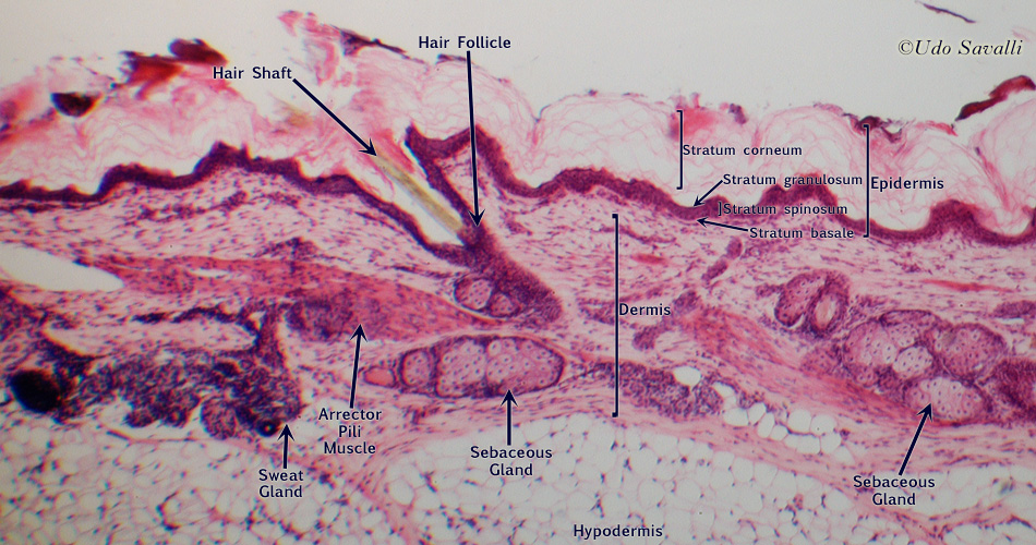 Skin labeled