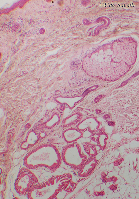 Glands unlabeled