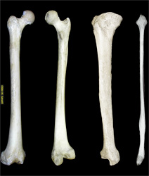 lower limb bones