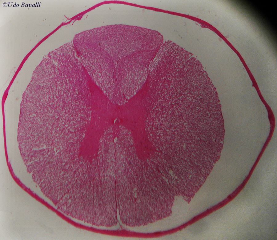 Spinal cord slide unlabeled