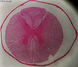 spinal chord slide