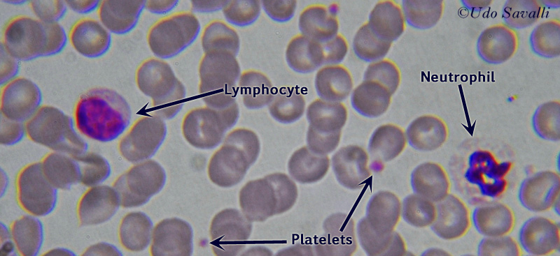 Blood Smear