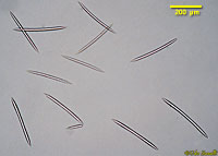 Spongilla Spicules